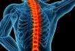 Spine Specialist Doctor in Chandigarh and Zirakpur Because it is widely thought that surgery is incredibly unpleasant, the majority of people wait until the worst has occurred before undergoing surgery. However, if you concentrate on busting misconceptions, you'll discover that technology has advanced in ways that make operations as comfortable and minimally intrusive as possible. The present state of spine surgery may be seen in a similar manner. Even if getting the procedure is recommended, you should consider finding the top experts. Amcare offers you the best spine expert in Zirakpur to treat your disturbed spine, giving the full range of effectiveness and recovery. Selecting a Certified Expert Over Other Candidates The advantages of selecting a Certified Expert for your spine surgery are incalculable, and it will be simpler to get back to your usual routine afterward. If you've been having trouble deciding which physicians to see and how to get better, Amcare will immediately put an end to your search by offering you faultless advantages. The best spine expert in Chandigarh has a firm foundation in the most advanced information and pain management techniques needed to treat any back or spine condition or discomfort. In this regard, spine care specialists are masters in persuading and inspiring patients to completely commit to rehabilitation. Total dedication to patient care Most people delay seeking therapy because the thought of suffering paralyzes them. Thanks to Amcare's top expert panel, you can be sure that you will get the best care possible for the lowest possible price. If tampered with or interrupted, the spine, which is your body's vital force, calls for considerable caution. If you don't treat it, you can later suffer severe consequences and lose mobility or exhibit erratically moving. This kind of circumstance is never acceptable. In order to guarantee that you can manage the pain and resume your usual activities, it is imperative that you treat yourself to competent spine treatment at Amcare. Modern Surgical Methods Amcare promises painless surgical care since it works with the best spine expert in Zirakpur. By employing one of the safest and most advanced surgical techniques, the doctors here make sure that patients are entirely at peace with the notion of pre- and post-surgery care. Here, you can count on the greatest standards of security to make recovery easy and fast. From careful planning for the surgery to providing post-operative care, the specialists work with you to assist your spine in regaining its natural structure and range of motion. Amcare provides a practical and modern perspective on healthcare. Cost-Saving Techniques The top hospitals will always let you know up front what they will charge you. If you decide to receive the greatest expert treatment for your spine at Amcare, you won't have to worry about the fees since they will be fair and simple to comprehend. Now that you know how expensive it will be to put off treatment, getting your spine corrected won't be a barrier for you. With state-of-the-art equipment and an effective treatment approach, Amcare's staff can give you the greatest quality care for the least amount of money spent on medical care. Plan Ahead for Your Treatment You should move cautiously and make an appointment to return your spine to its previous level of mobility now that you are aware of Amcare's status as the leading provider of spine care. The top spine surgeon in Chandigarh can fix your spine and put an end to your concerns about pain and immobility. He has a promising medical background and a track record of effective surgical procedures. Without further ado, get your treatment fix at Amcare, where quality and costs are unsurpassed.