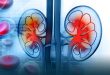Amcare is the best hospital in Chandigarh, providing all of the finest amenities and a knowledgeable team of kidney specialists