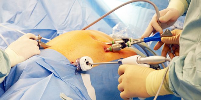 Laparoscopic surgery in Mumbai