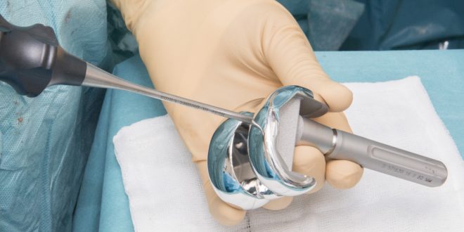 Knee replacement surgery in Delhi
