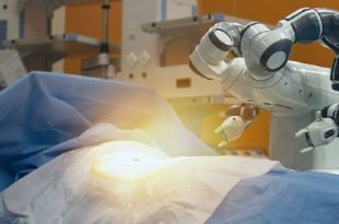 FT-3D Knee Resurfacing in India