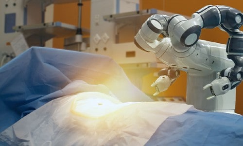 FT-3D Knee Resurfacing in India