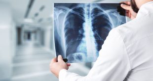 cheapest X-ray in Panchkula