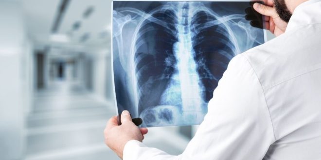 cheapest X-ray in Panchkula