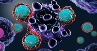 Cancer Specialist Surgeon in Chandigarh