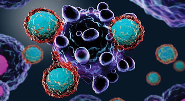 Cancer Specialist Surgeon in Chandigarh