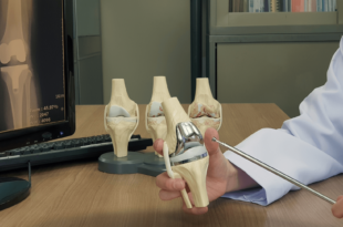 Best Knee Replacement Doctor in Chandigarh