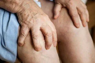 Famous Arthritis Specialist in Mumbai