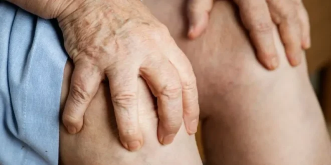 Famous Arthritis Specialist in Mumbai