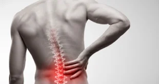 Back Pain Doctor in Chandigarh