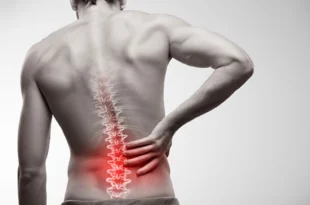 Back Pain Doctor in Chandigarh