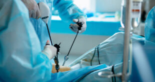 endoscopy test in Chandigarh