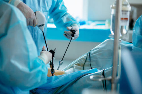 endoscopy test in Chandigarh