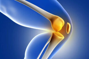 knee replacement surgeon in Mohali