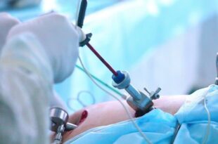 Laparoscopic surgeon in Kandivali