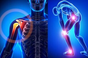 Joint Specialist Surgeon in Mumbai