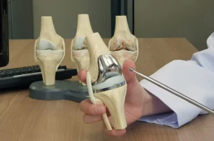 knee replacement surgery in Jaipur