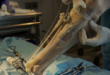 Best Orthopedic Surgeon in Mumbai