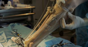 Best Orthopedic Surgeon in Mumbai