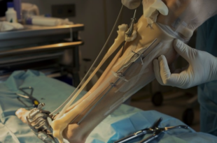 Best Orthopedic Surgeon in Mumbai