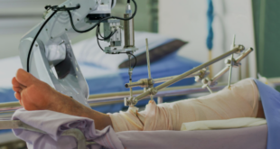 knee replacement surgery in Delhi