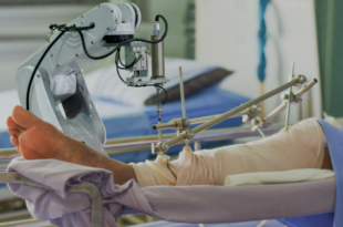 knee replacement surgery in Delhi