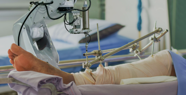 knee replacement surgery in Delhi