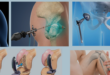 orthopedic surgeon near me