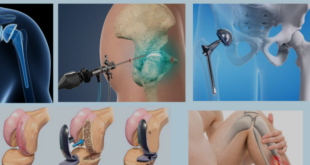 orthopedic surgeon near me