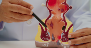 best piles treatment doctor in Panchkula