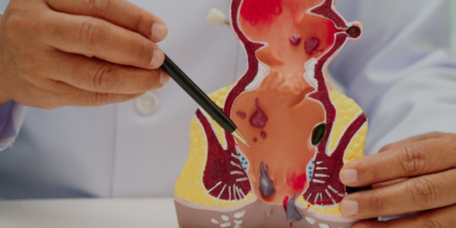 best piles treatment doctor in Panchkula