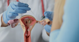 Best Gynaecologists in Panchkula