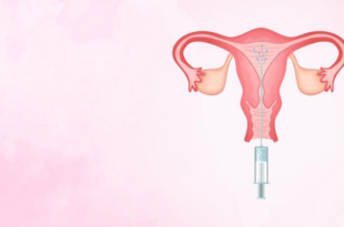 Best IUI treatment in Kandivali West