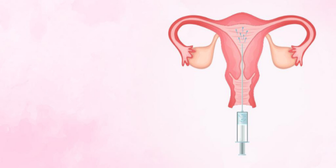 Best IUI treatment in Kandivali West