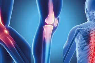 Bone Specialist in Mumbai