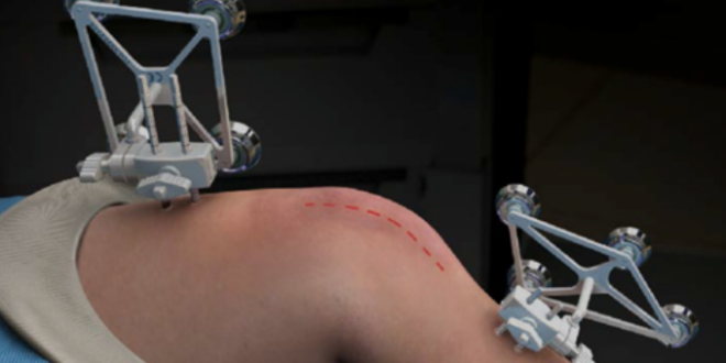 partial knee replacement in Goa