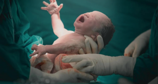 Best Gynaecologist for a Caesarean Delivery in Panchkula