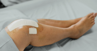 Knee Replacement Surgery in Lucknow