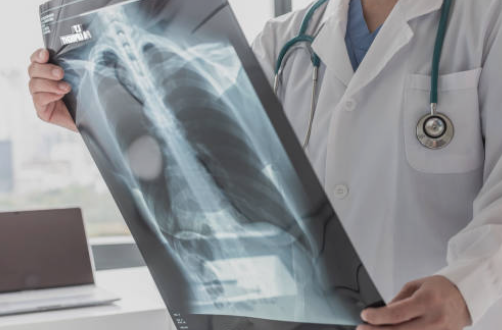 best lung doctor in Chandigarh