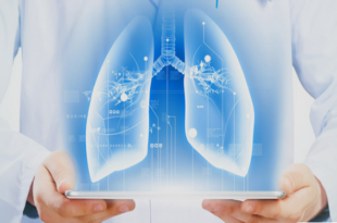 best pulmonologist in Panchkula