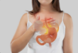 stomach specialist in Chandigarh