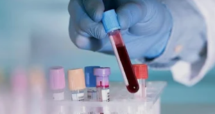 CGHS Empanelled Lab in Chandigarh