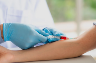 Home Blood Sample Collection Chandigarh