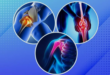 joint replacement surgery Goa