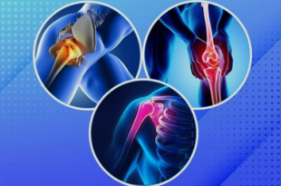 joint replacement surgery Goa