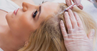PRP hair treatment