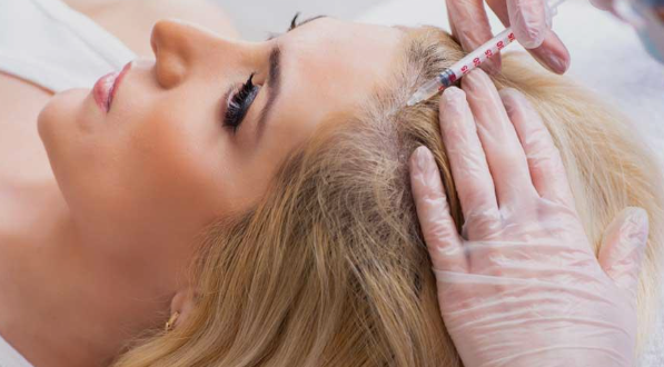 PRP hair treatment