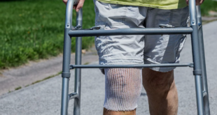 Knee replacement surgery in indore