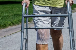 Knee replacement surgery in indore