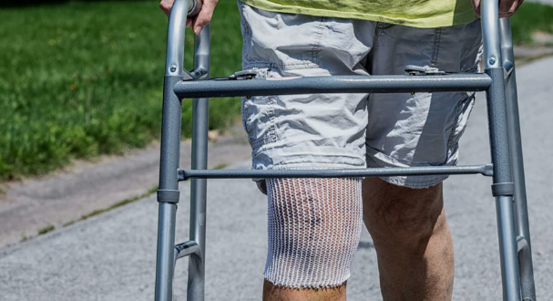 Knee replacement surgery in indore